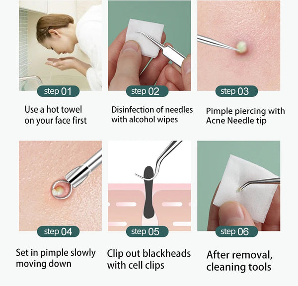Phansta™  Pure Pore Tool Kit 